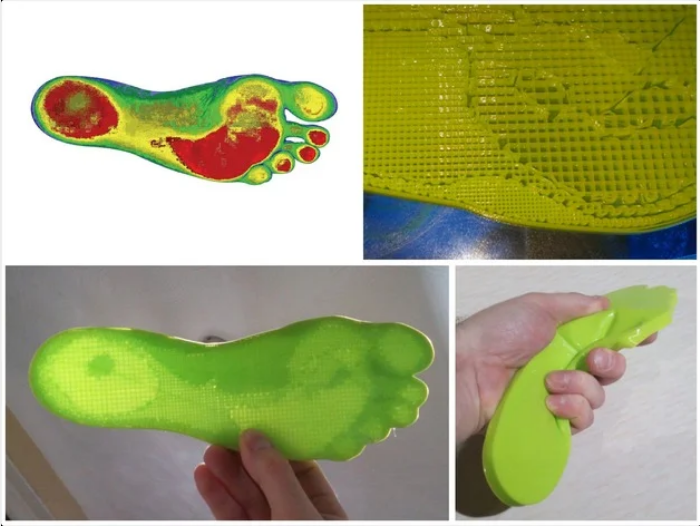 Variable Density Insole by Gyrobot